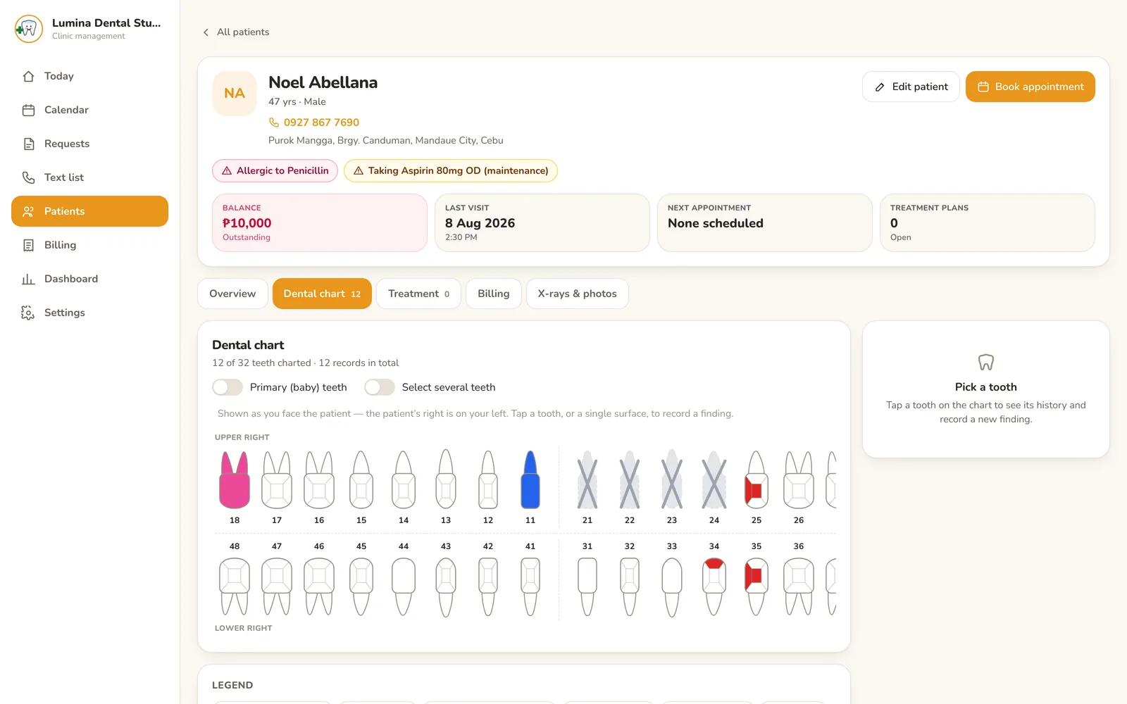 Dental clinic system: patient chart with interactive per surface odontogram
