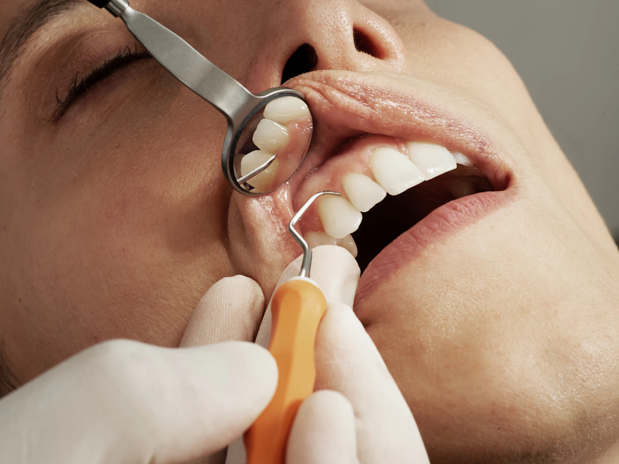 Placeholder close-up photograph of a dental examination